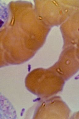 Yersinia pestis bacteria.